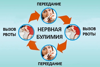 Лечение булимии в Лысково